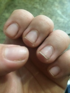 Back to my stumpy, plain nails!